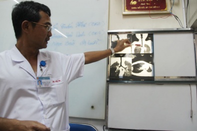 Tìm thấy đồ chơi 'mất tích' sau 7 tháng khi bé trai ho ra tiếng kèn