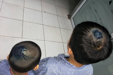 Đừng đùa với bệnh hiếm gặp do chơi với chó, mèo 