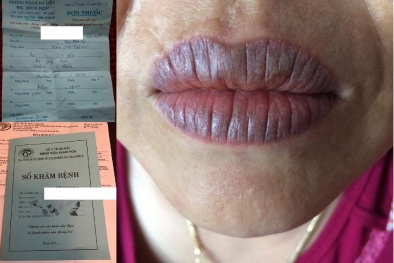 Dịch vụ thẩm mỹ: Quyền lợi khách hàng thường bị 'bỏ quên'