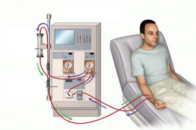 Chạy thận nhân tạo: Những tai biến rủi ro ai cũng phải biết