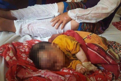 Nổ bếp ga kinh hoàng ở Lào Cai: 10 người trong đó có 3 trẻ em bỏng nặng