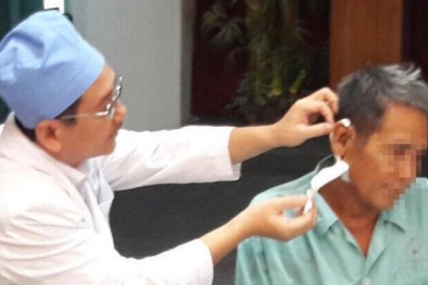 Nhiễm trùng, áp xe tai do thói quen lấy ráy tai bằng tăm nhang ​