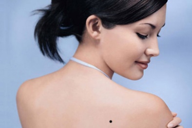 Những vị trí nốt ruồi trên lưng cực quý hiếm, nhiều 'lộc' 