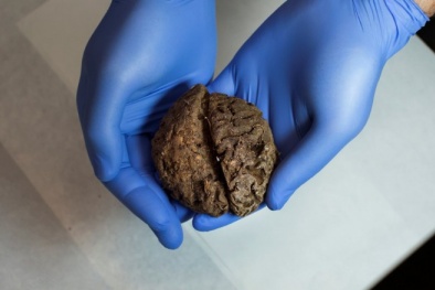 Phát hiện hàng chục bộ não còn nguyên vẹn trong ngôi mộ tập thể 80 năm tuổi