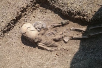 Giải mã thành công bí ẩn về hộp sọ thuôn dài nghi là người ngoài hành tinh