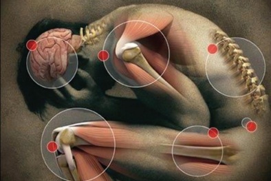Trắc nghiệm cảnh báo cấp độ độc tố cơ thể của Gs.Nhật Bản ai cũng nên thực hiện 1 lần