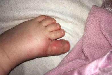 Bệnh lây truyền từ loài chó rất khủng khiếp không phải ai cũng biết