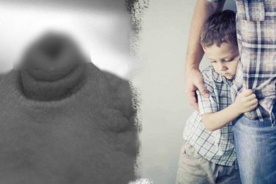 Phát hoảng vì càng lớn, 'vùng nhạy cảm' của con càng.. teo đi