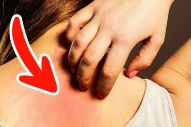 Nếu cơ thể bạn xuất hiện những dấu hiệu này, coi chừng ung thư đang 'tấn công'