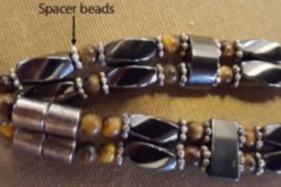 Một bé gái nhiễm độc chì bởi vòng tay 'vi lượng đồng căn'