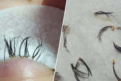 Cảnh báo: Gắn mi giả coi chừng 'đi' luôn mi thật