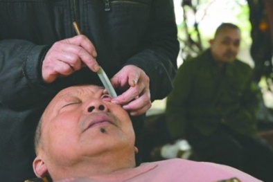 Rợn người xem làm sạch tròng mắt bằng dao cạo của người Trung Quốc