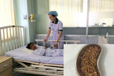 Cha mẹ cho con ăn quả sơ ri nên biết điều này kẻo có ngày ‘mất con’