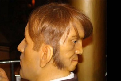 Bí ẩn 'quái nhân' 2 mặt khiến nhiều người khiếp sợ