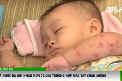 Cả nước đã ghi nhận hơn 70.000 trường hợp mắc tay chân miệng
