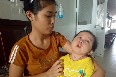 Nghẹn ngào bé gái hơn 1 tuổi bị côn trùng đốt khiến teo não, chân tay bị co quắp