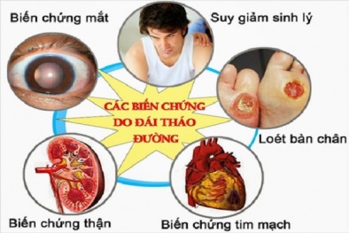 Chế độ ăn không hợp lý là nguyên nhân hàng đầu gây đái tháo đường