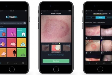 Bất ngờ với ứng dụng phát hiện bệnh da liễu thông qua ảnh chụp của Apple