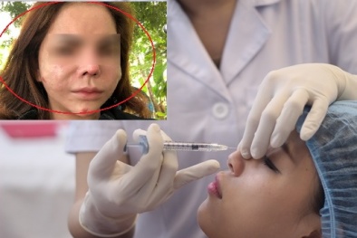 Hiểm họa làm đẹp bằng silicon lỏng