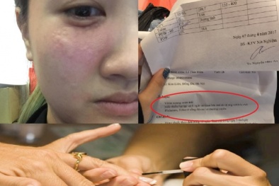 Dễ vô sinh vì 'bộ ba độc tố' có trong sơn móng 