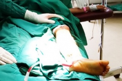 Đến thầy lang 'chữa mẹo' bé trai suýt mất mạng