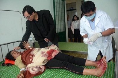 Hội chứng viêm da dày sừng xuất hiện: Bộ Y tế đã có chỉ đạo