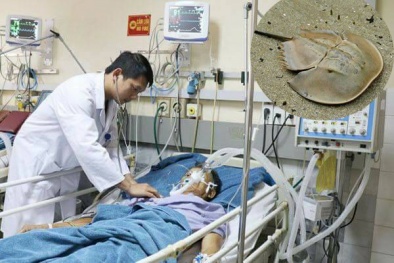 Quảng Ninh: Ăn So biển ngộ độc hai ngư dân bị liệt toàn thân