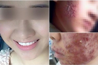 Cẩn trọng với thực phẩm collagen làm đẹp cấp tốc