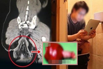 Ngồi toilet chơi game, người đàn ông bất ngờ bị tụt ruột ra ngoài