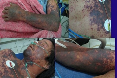 5 biện pháp phòng chống liên cầu lợn ai cũng phải 'nằm lòng'