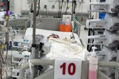 Bé trai 7 tuổi suy đa cơ quan nguy kịch vì mắc sốt xuất huyết