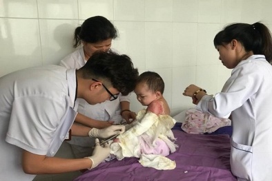 Bà mẹ bất cẩn khiến bé gái 4 tuổi bỏng nước sôi toàn thân 