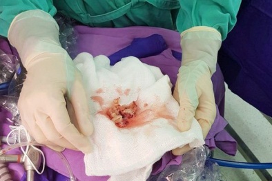 Đau bụng kèm theo sốt, cẩn thận kẻo bé mắc bệnh nguy hiểm ‘chết người’ này