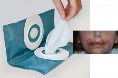 Quản lý khăn ướt: Mỹ, EU coi là mỹ phẩm, Việt Nam ban hành tiêu chuẩn quốc gia