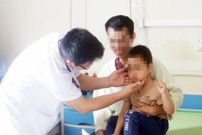 Lạm dụng thuốc Corticoid bé trai 5 tuổi bị suy thượng thận