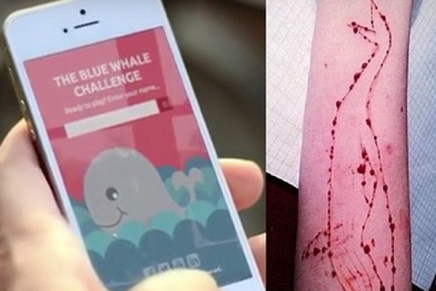 Thử thách Cá voi xanh: Nạn nhân sống sót tiết lộ kí ức kinh hoàng về trò chơi