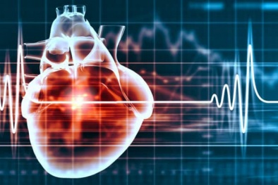 Những người bị rối loạn nhịp tim, động mạch cảnh có nguy cơ cao mắc chứng sa sút trí tuệ