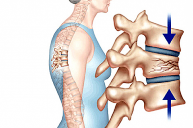 3 dấu hiệu nhận biết loãng xương không nên bỏ qua