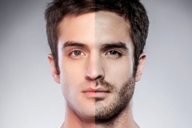 Biến chứng 'chết người' vì trào lưu cấy râu thể hiện sự nam tính