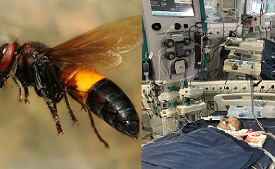 Có thể tử vong nếu tự xử lý vết ong đốt sai cách tại nhà