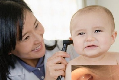 Bấm lỗ tai cho trẻ nhỏ quá sớm nguy cơ biến chứng nguy hiểm