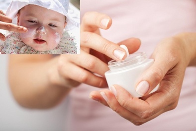 Coi chừng tác dụng ngược nếu dùng kem chống nẻ cho trẻ sai cách