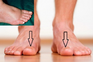 Cần đi khám thận ngay lập tức nếu bàn chân xuất hiện dấu hiệu lạ