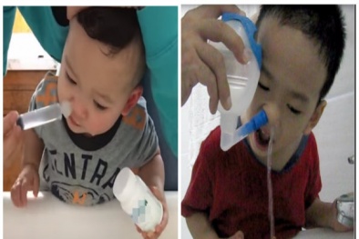 Bác sĩ cảnh báo: Rửa mũi cho trẻ bằng xi lanh hay bình rửa vào mùa đông đều rất nguy hiểm 