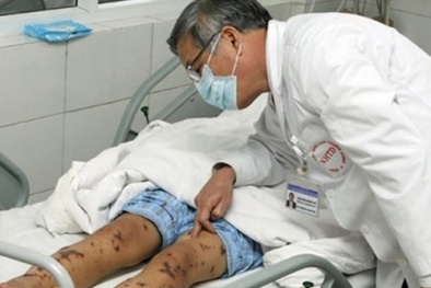 Nguy cơ nhiễm khuẩn liên cầu lợn tăng cao trong dịp Tết