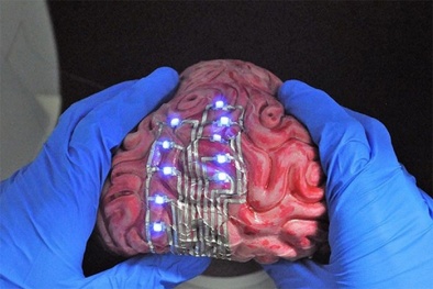 Kỳ lạ loại 'hình xăm điện tử' được dán trên bề mặt não để theo dõi sức khỏe con người