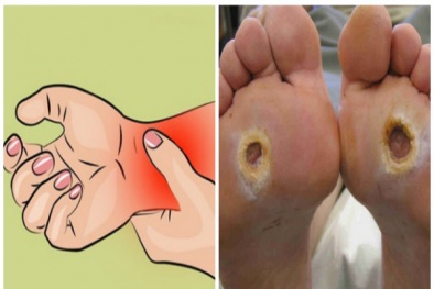Thấy tay chân bị tê chớ nên coi thường vì có thể đang mắc nhiều bệnh nguy hiểm