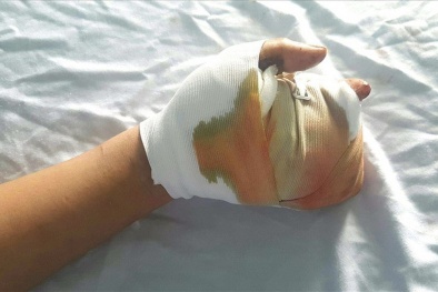 Tan nát bàn tay vì pháo tự chế
