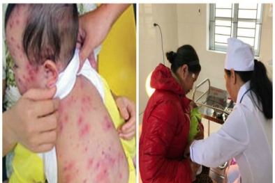 Trẻ mắc sởi tăng cao do không tiêm phòng, cảnh báo biến chứng gây tử vong