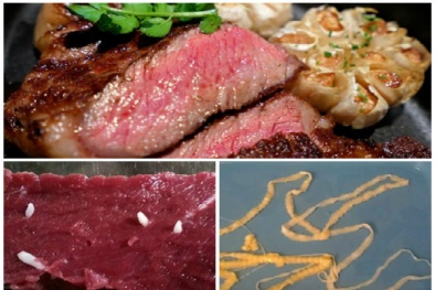 Ăn thịt bò tái có thể mắc bệnh nguy hiểm, biến chứng tử vong